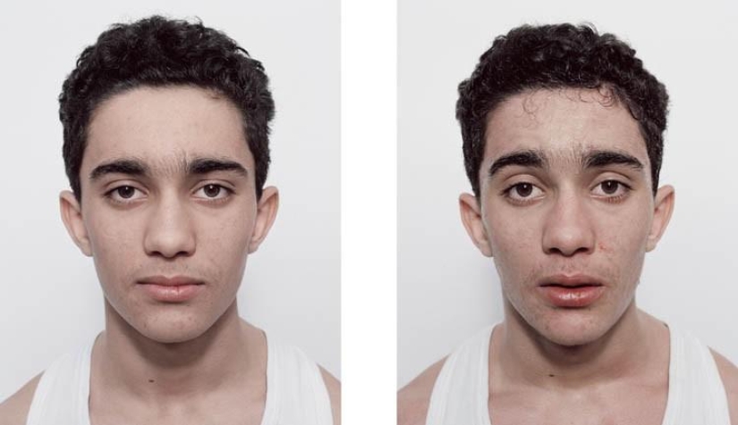 Boxeadores jóvenes: antes y después de la pelea