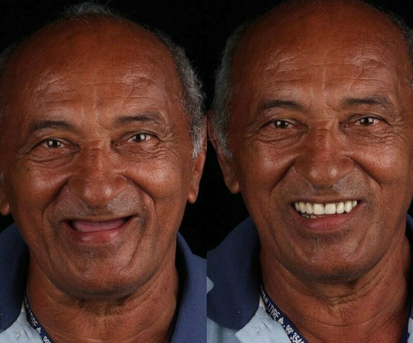 Brazilian dentist helps poor people shine with a snow-white smile