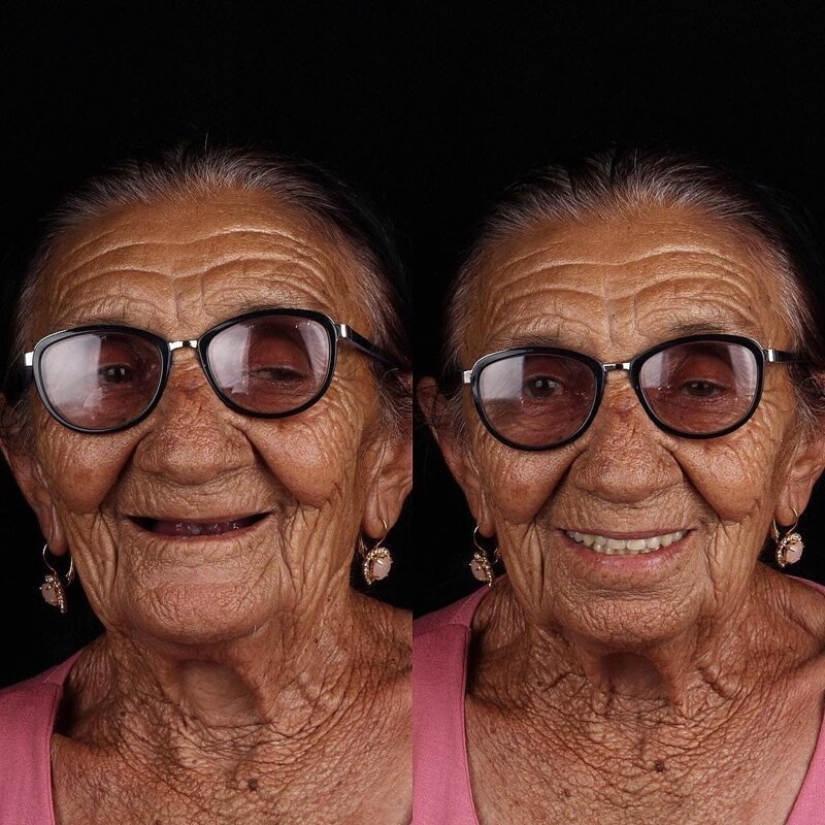 Brazilian dentist helps poor people shine with a snow-white smile