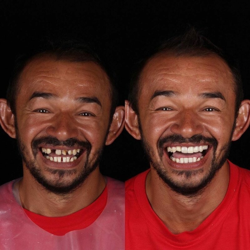Brazilian dentist helps poor people shine with a snow-white smile