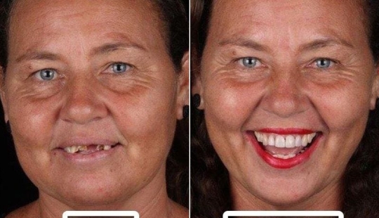 Brazilian dentist helps poor people shine with a snow-white smile