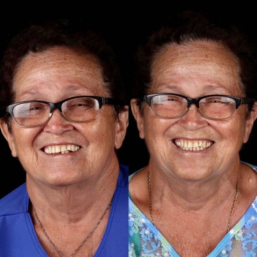 Brazilian dentist helps poor people shine with a snow-white smile
