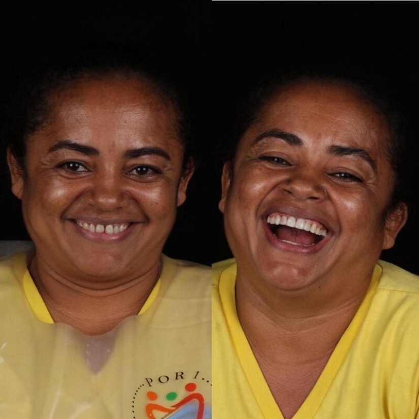 Brazilian dentist helps poor people shine with a snow-white smile