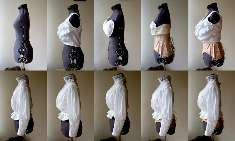 Breast augmentation 100 years ago. How was it?