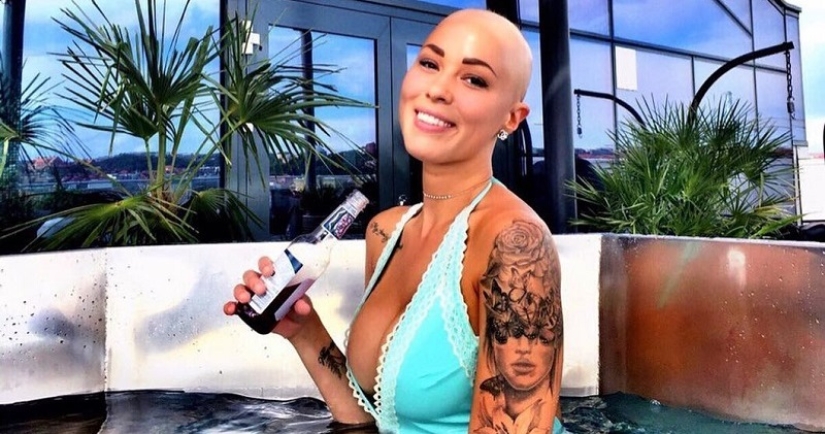 Brillante: cómo una niña calva dejó de ser tímida y se convirtió en una estrella