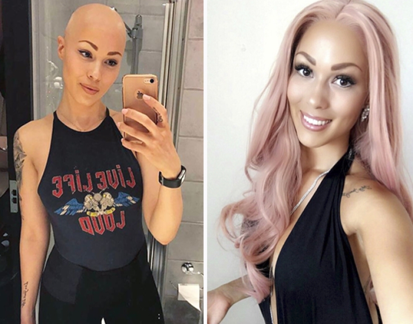 Brilliant: how a bald girl stopped being shy and turned into a star Brilliant: how a bald girl stopped being shy and turned into a star