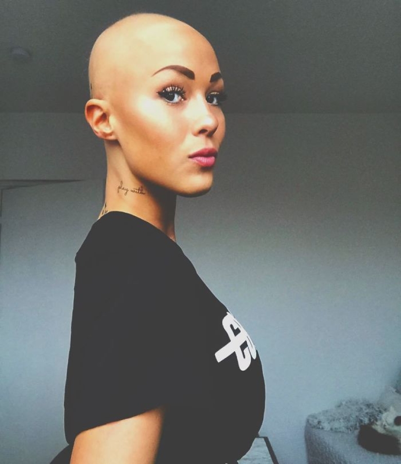 Brilliant: how a bald girl stopped being shy and turned into a star Brilliant: how a bald girl stopped being shy and turned into a star