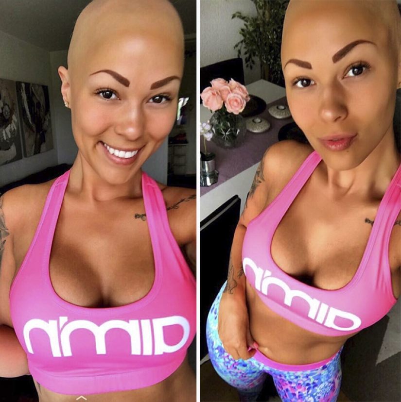 Brilliant: how a bald girl stopped being shy and turned into a star Brilliant: how a bald girl stopped being shy and turned into a star