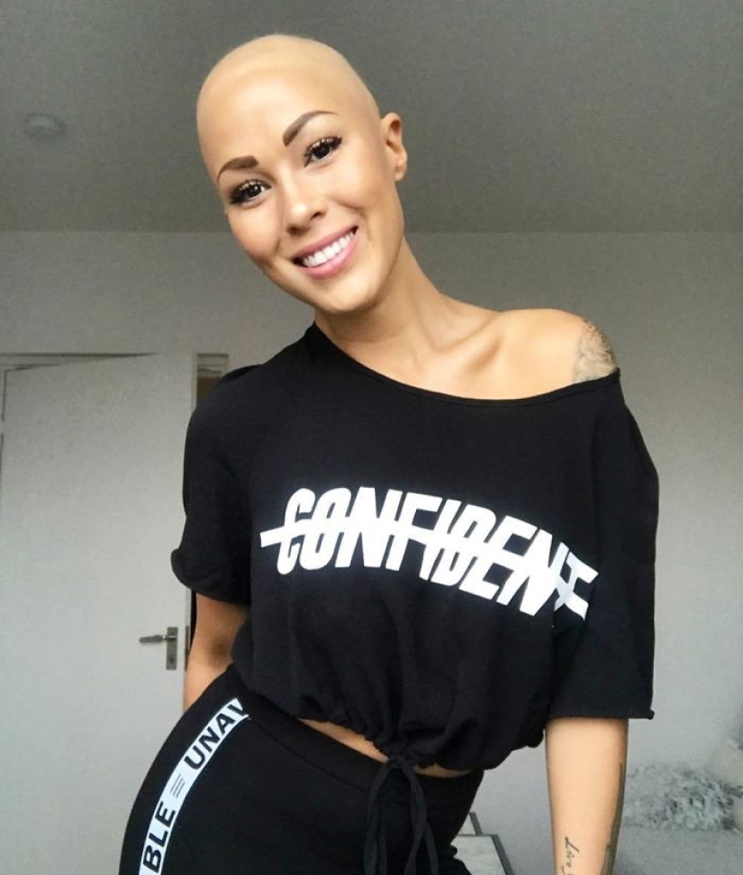 Brilliant: how a bald girl stopped being shy and turned into a star Brilliant: how a bald girl stopped being shy and turned into a star