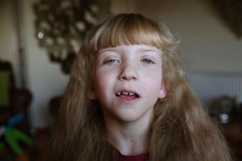 British gay adopted four disabled children and is immensely happy