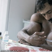 Bulbosaurus de Brasil: ex drogadicto se inyecta aceite