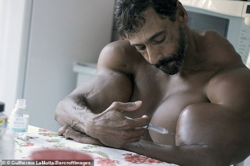 Bulbosaurus from Brazil: former drug addict gives himself oil injections