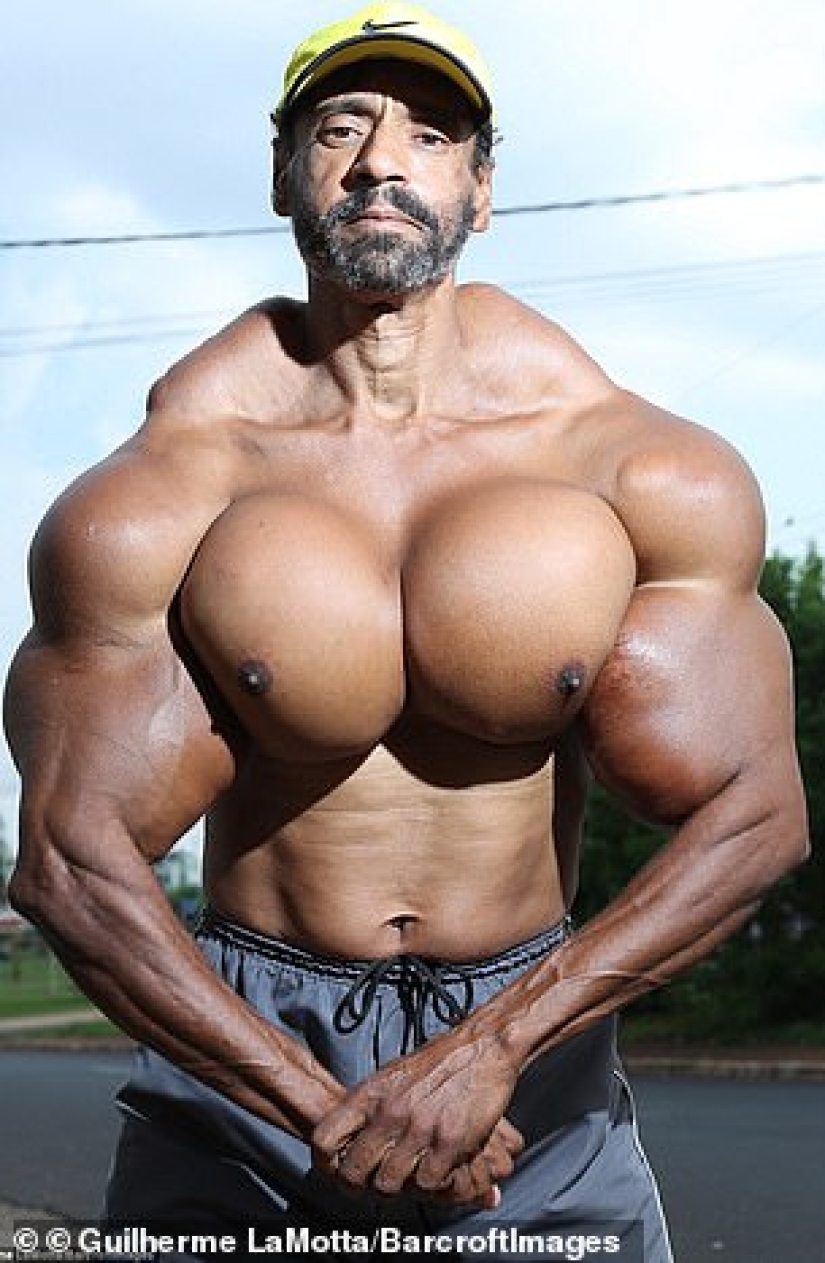 Bulbosaurus from Brazil: former drug addict gives himself oil injections