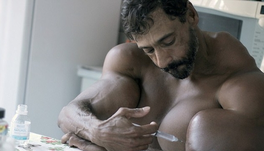 Bulbosaurus from Brazil: former drug addict gives himself oil injections Bulbosaurus from Brazil: former drug addict gives himself oil injections