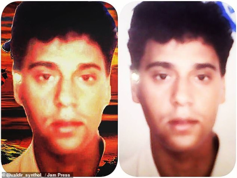 Bulbosaurus from Brazil: former drug addict gives himself oil injections