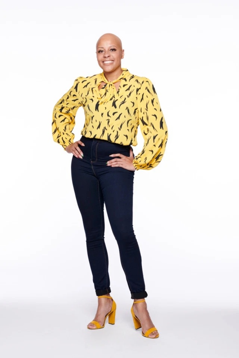 Calvas, valientes, orgullosas: mujeres que aprendieron a vivir con alopecia y se enamoraron de sí mismas sin pelo