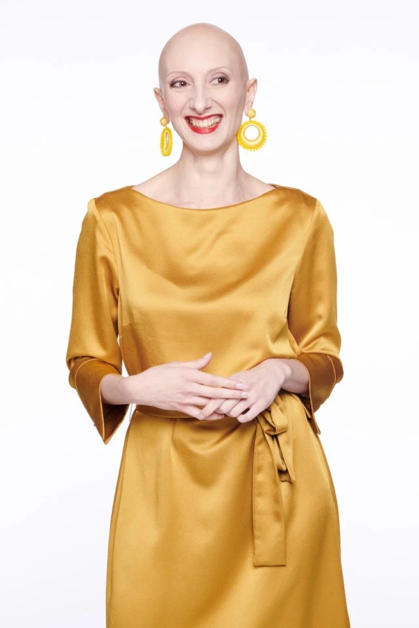 Calvas, valientes, orgullosas: mujeres que aprendieron a vivir con alopecia y se enamoraron de sí mismas sin pelo