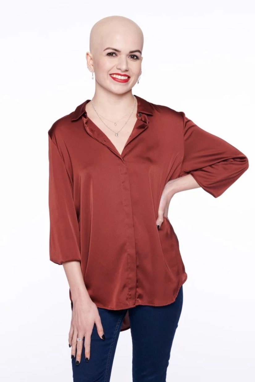 Calvas, valientes, orgullosas: mujeres que aprendieron a vivir con alopecia y se enamoraron de sí mismas sin pelo