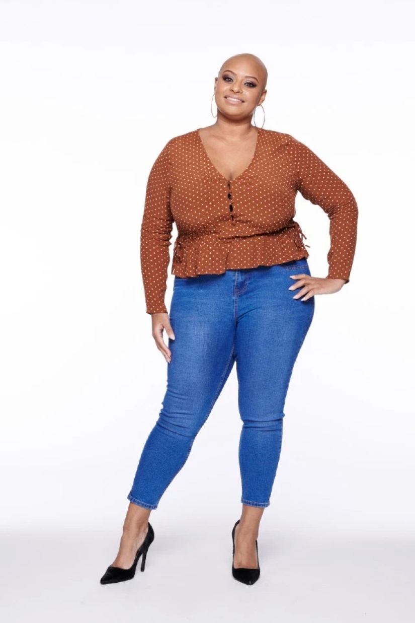 Calvas, valientes, orgullosas: mujeres que aprendieron a vivir con alopecia y se enamoraron de sí mismas sin pelo