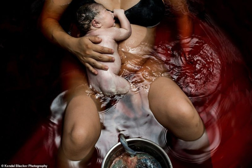 Celebration of life: the first tears, joy, cry and pain in the photos of the annual contest "Birth Becomes Her"