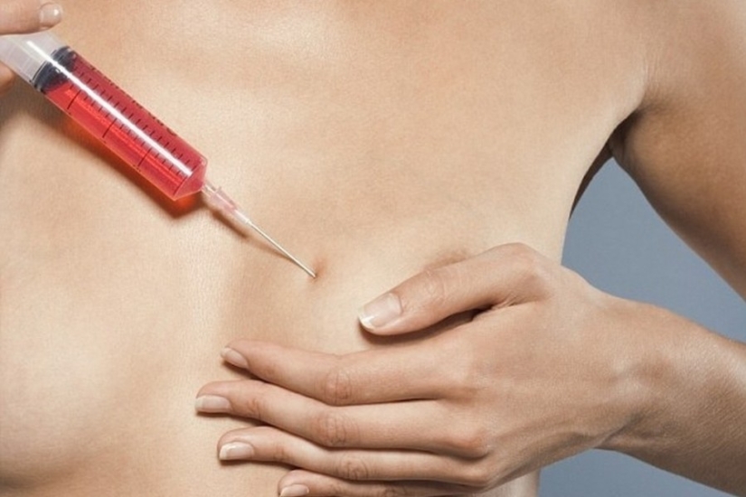 "Cinderella plastic surgery": Japanese practice breast augmentation for a day