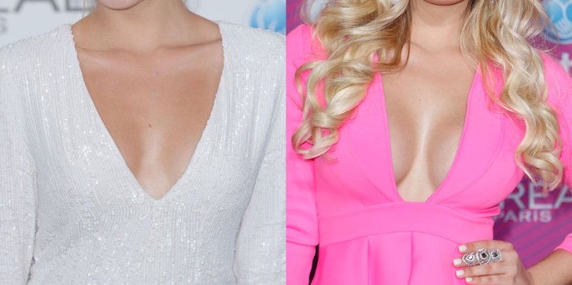 "Cirugía plástica de cenicienta": las japonesas practican el aumento de senos por un día