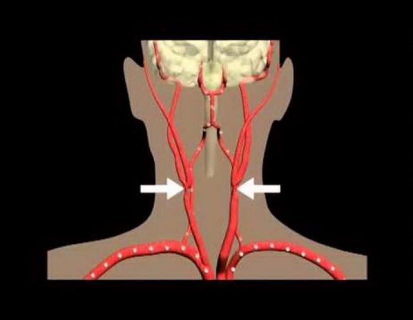 Cómo deshacerse del dolor en la antigüedad. Cómo deshacerse del dolor en la antigüedad.