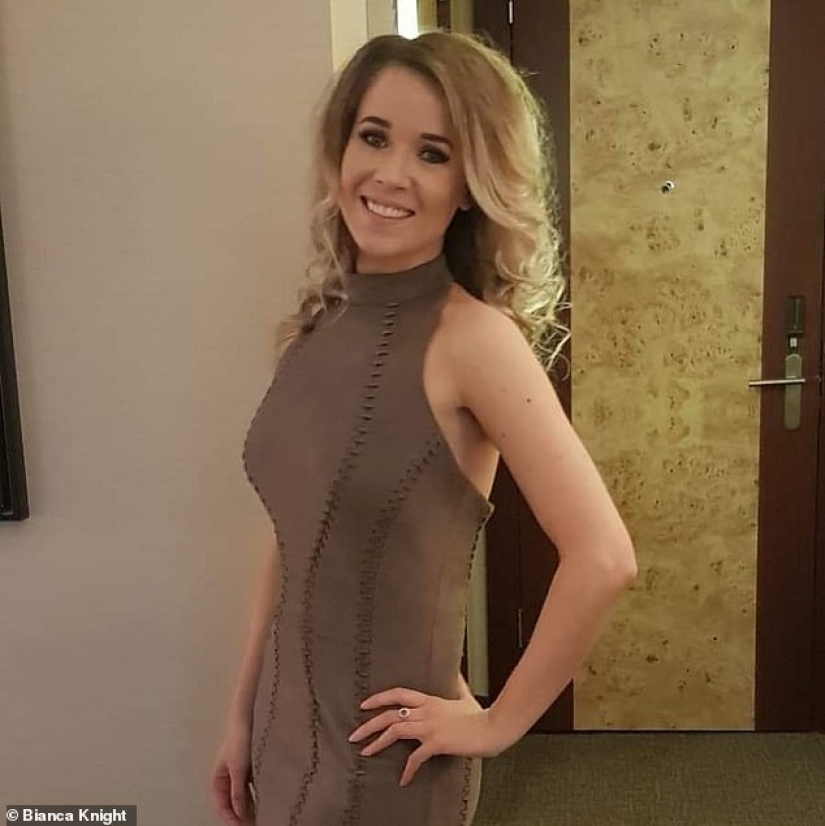 Cómo envejecen la piel un teléfono y una computadora: una joven se horrorizó por los efectos de la radiación en su cara