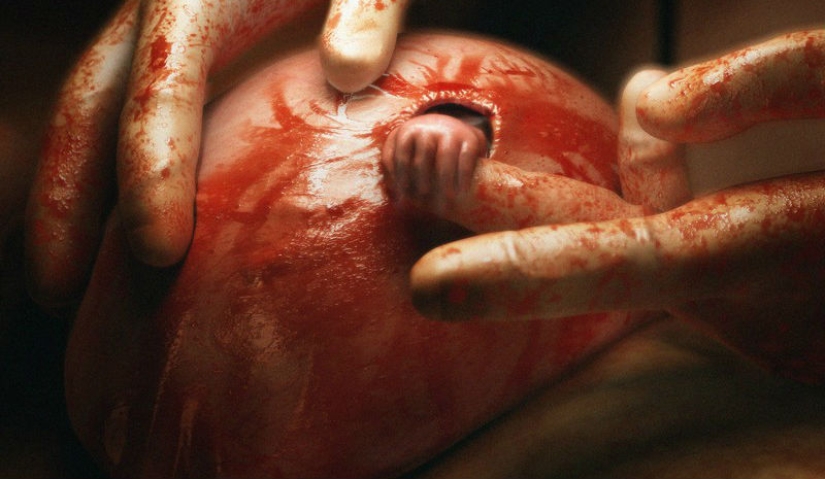 Cómo se ve hoy el niño de la famosa foto "La mano de la esperanza" Cómo se ve hoy el niño de la famosa foto "La mano de la esperanza"