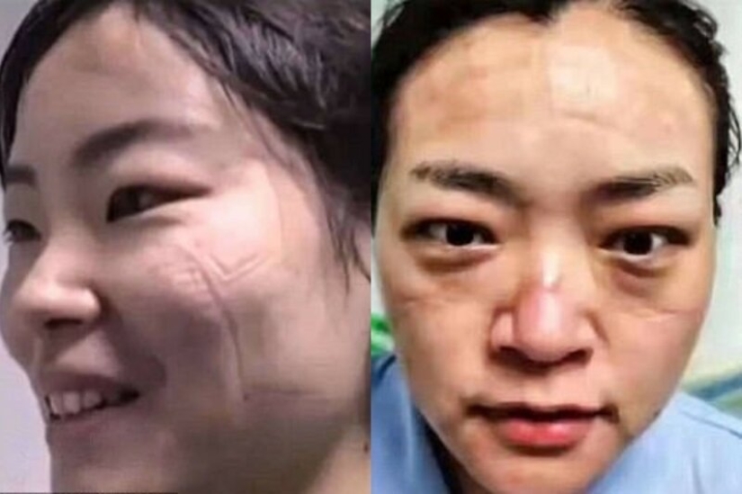 Cómo se ven las caras de los médicos chinos al final de un turno de trabajo