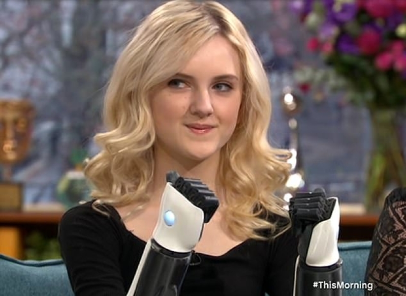 Cómo una niña de 13 años con prótesis biónicas en lugar de manos se convirtió en maquilladora profesional