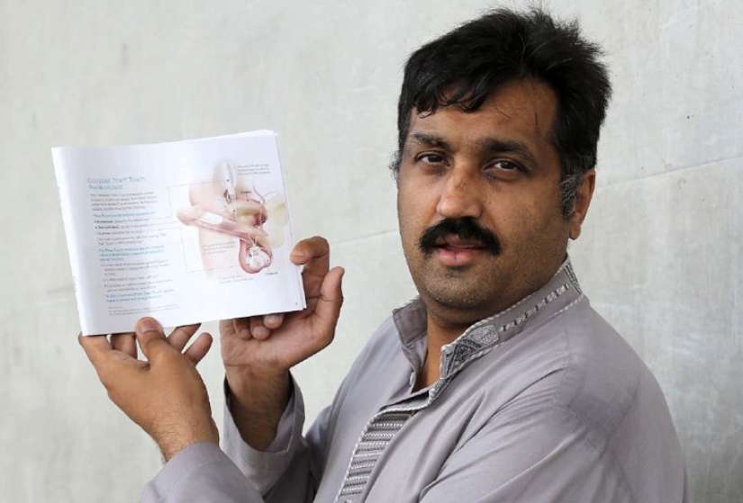 Cómo vive un hombre con un pene biónico Cómo vive un hombre con un pene biónico