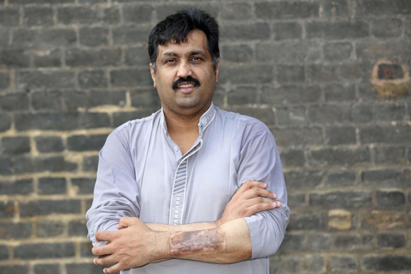 Cómo vive un hombre con un pene biónico