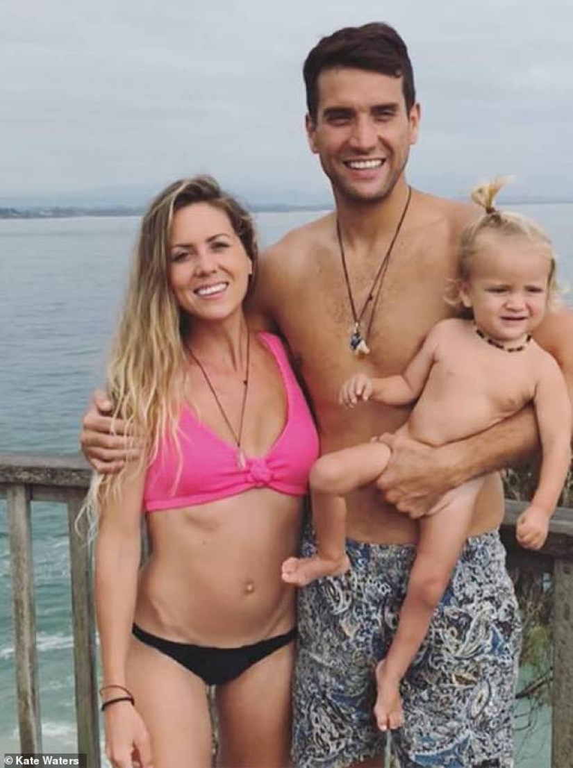 "Con ellos, mi vida se convirtió en un infierno": una mujer australiana contó por qué se deshizo de los implantes mamarios