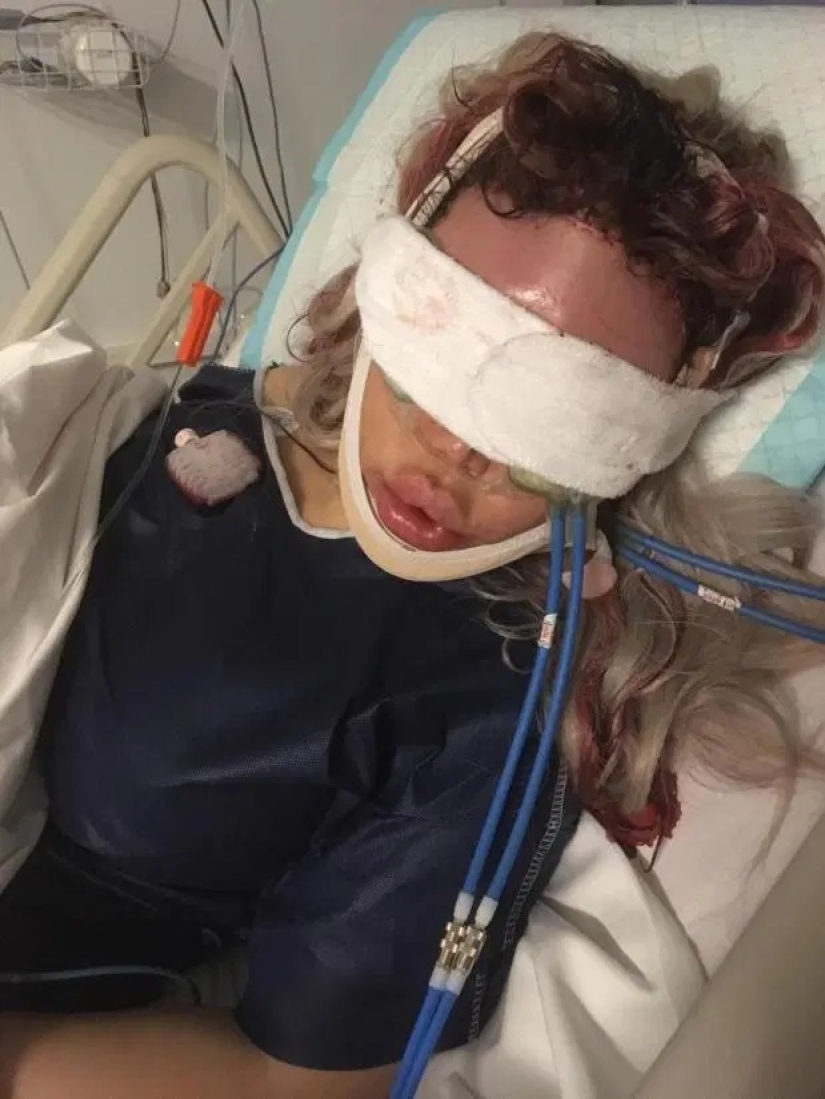 De Ken a Barbie: la muñeca humana ha cambiado de género y planea convertirse en madre