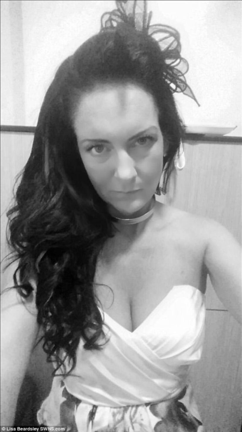 Debido al herpes zóster, la mujer británica ahora tiene la cara de una "perra gruñona" Debido al herpes zóster, la mujer británica ahora tiene la cara de una "perra gruñona"