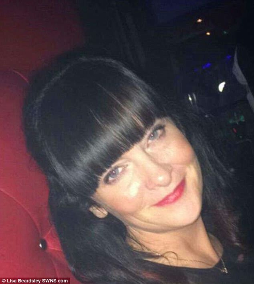 Debido al herpes zóster, la mujer británica ahora tiene la cara de una "perra gruñona" Debido al herpes zóster, la mujer británica ahora tiene la cara de una "perra gruñona"