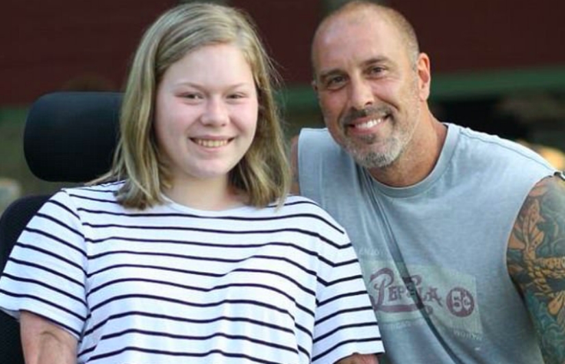 Debido al terrible virus, las extremidades de la niña fueron amputadas, pero aprendió a tocar el piano