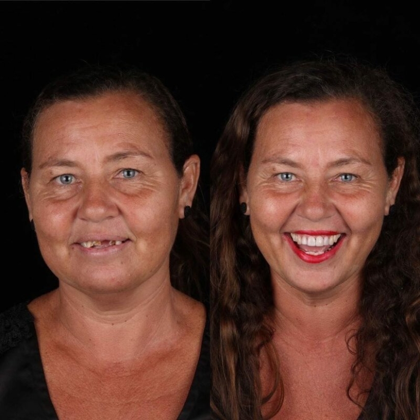 Dentista brasileño ayuda a los pobres a brillar con una sonrisa blanca como la nieve