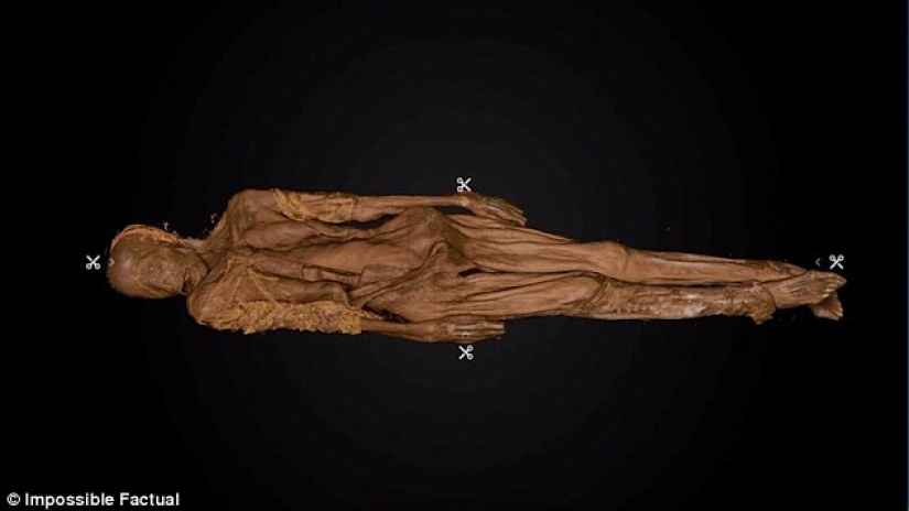 Died of smallpox in 1851: the identity of the girl buried in an iron coffin in New York is established Died of smallpox in 1851: the identity of the girl buried in an iron coffin in New York is established