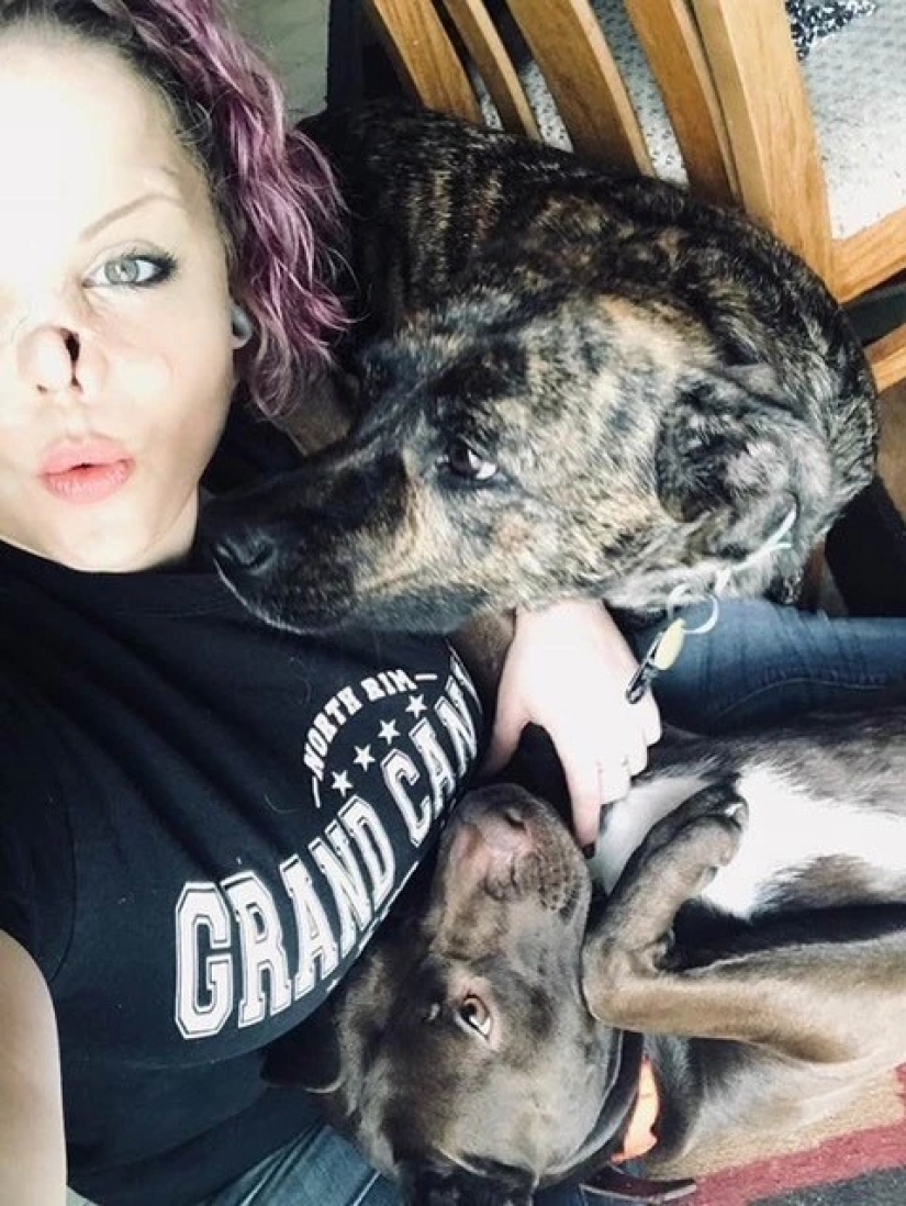 Disfigured love: a pit bull bit off a girl's nose, but she forgave him and continues to cuddle with dogs Disfigured love: a pit bull bit off a girl's nose, but she forgave him and continues to cuddle with dogs