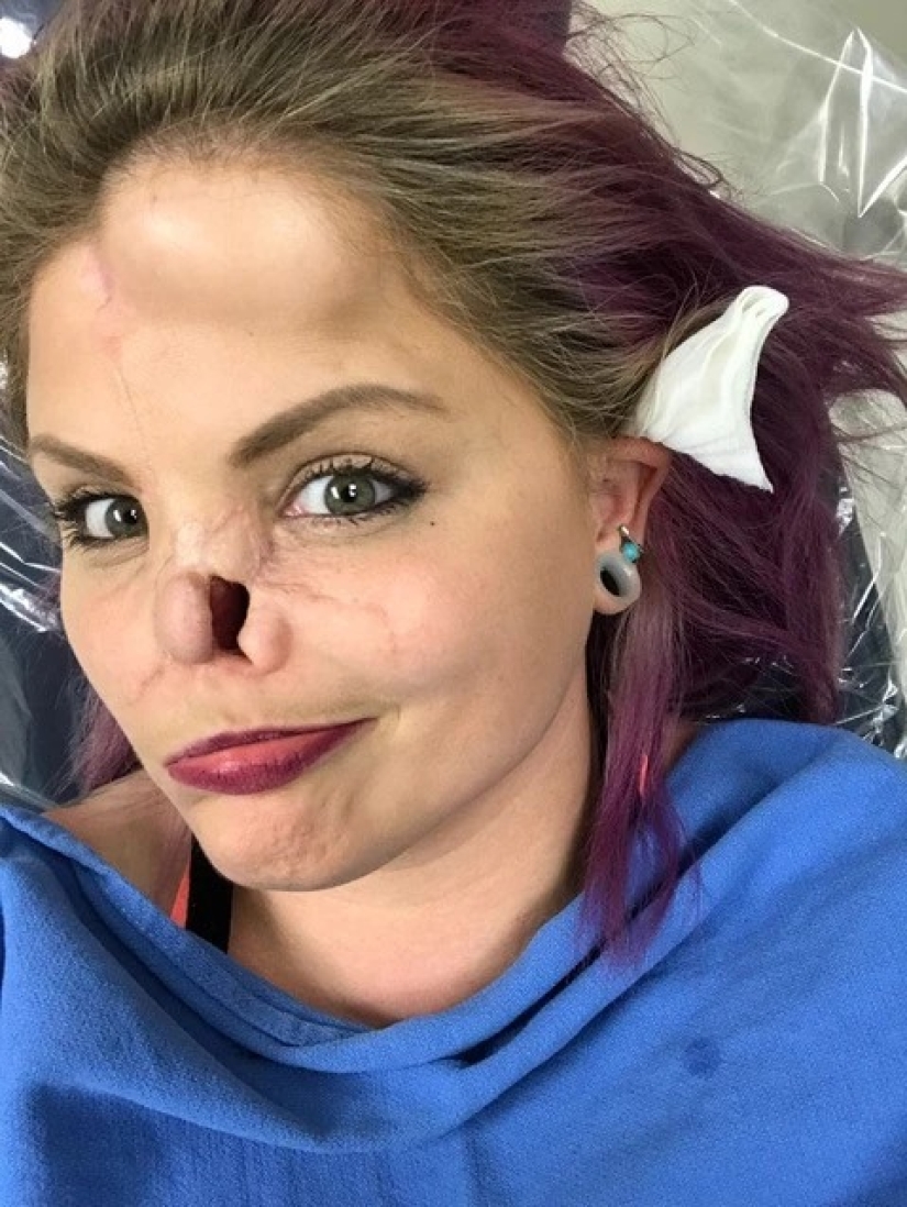 Disfigured love: a pit bull bit off a girl's nose, but she forgave him and continues to cuddle with dogs Disfigured love: a pit bull bit off a girl's nose, but she forgave him and continues to cuddle with dogs