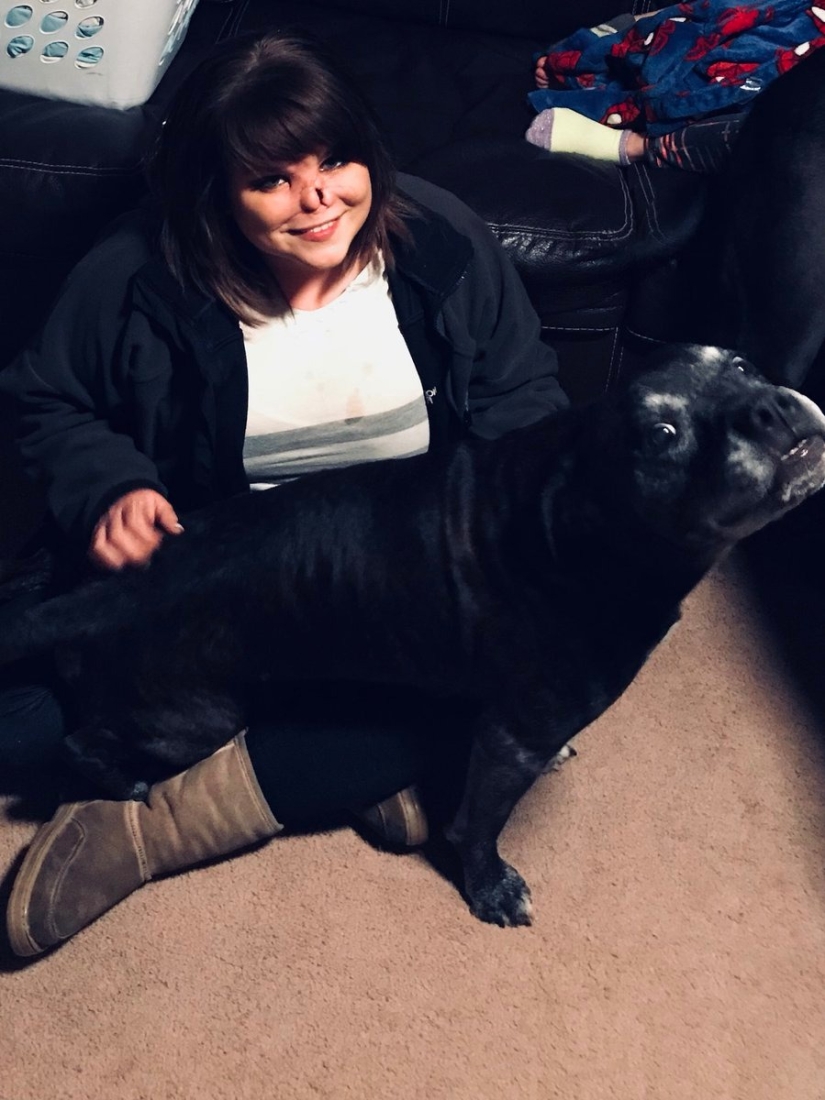 Disfigured love: a pit bull bit off a girl's nose, but she forgave him and continues to cuddle with dogs Disfigured love: a pit bull bit off a girl's nose, but she forgave him and continues to cuddle with dogs