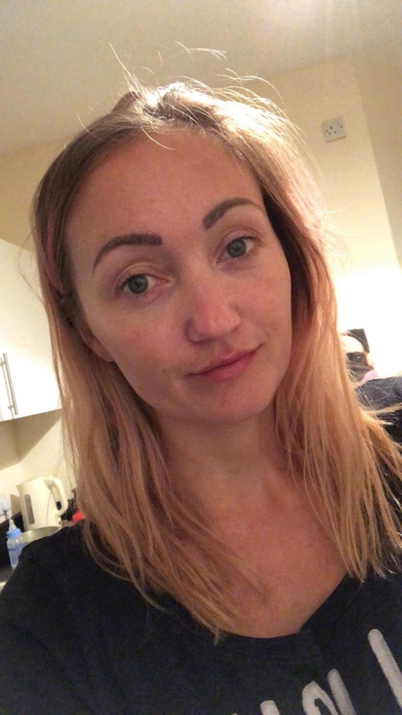 Efecto Benjamin Button: mujer británica de 31 años "envejece al revés" y se ve más joven que a los 15