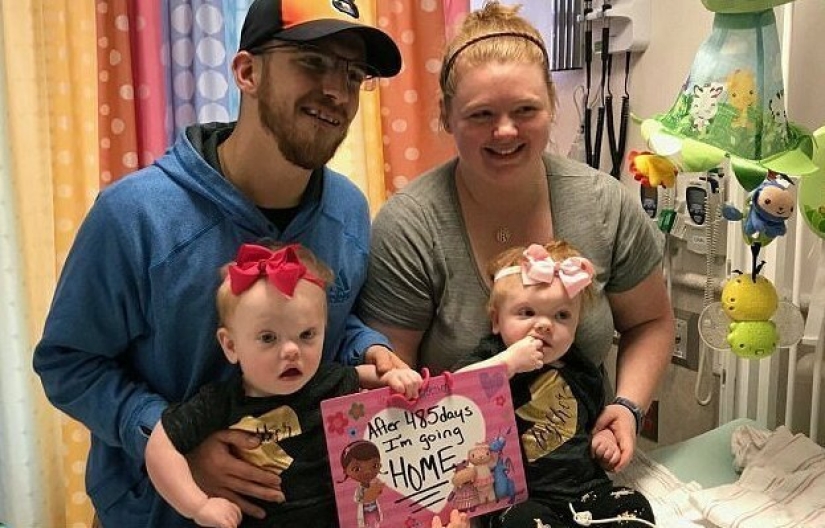 El derecho a la vida: gemelos siameses de 1,5 años, nacidos con la cabeza fusionada, se recuperaron de una operación complicada y se regocijan todos los días