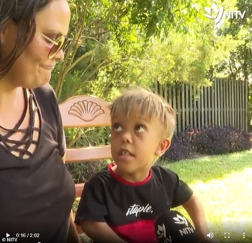 El gran corazón de un hombrecito: un comediante estadounidense recaudó 2 200,000 para ayudar a un niño enano