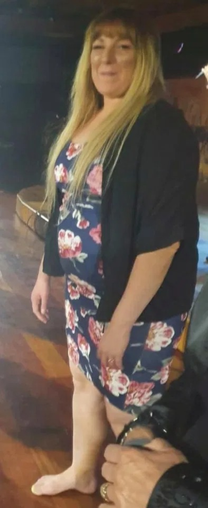 El miedo es el mejor motivador: tres mujeres perdieron peso debido al miedo a caer en el grupo de riesgo de Covid-19