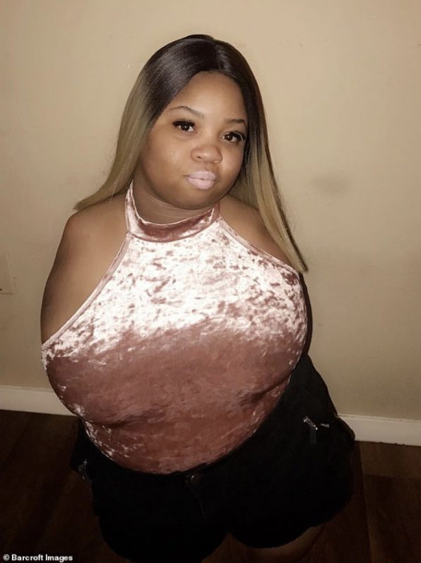 El poder del amor que todo lo conquista: una niña sin brazos y piernas se casa con un hombre completamente sano