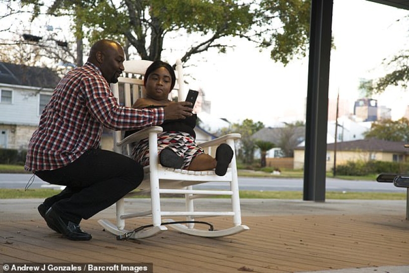 El poder del amor que todo lo conquista: una niña sin brazos y piernas se casa con un hombre completamente sano