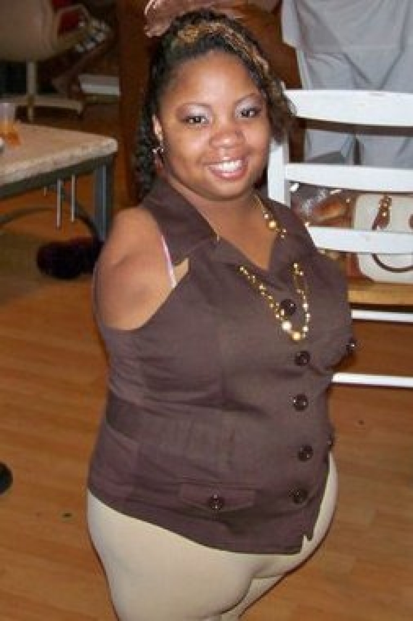 El poder del amor que todo lo conquista: una niña sin brazos y piernas se casa con un hombre completamente sano